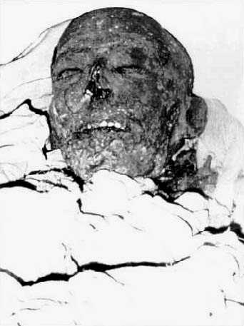 De mummie van Ramses IX